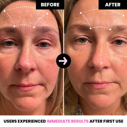 CollagenBio™ Collagen Face Mask by Biodance
